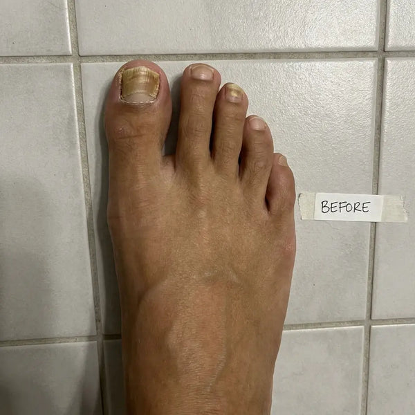 PRIMA