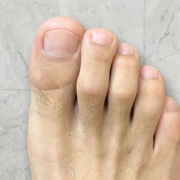 DOPO